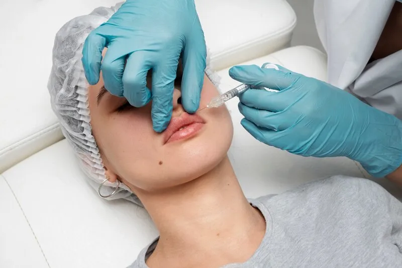 Lip filler treatment