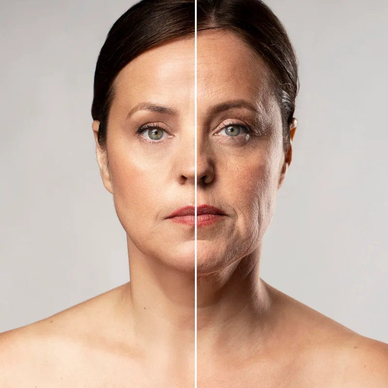 Fine lines skin treatment